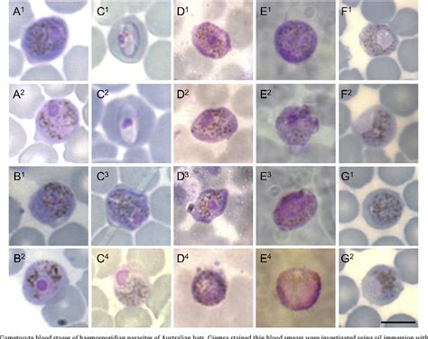  Hepatocystis! Den mystiska parasiten som gömmer sig i en oväntad värd